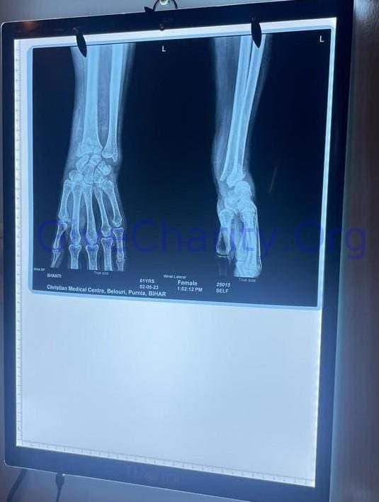 Shanti P._X-Ray.jpeg